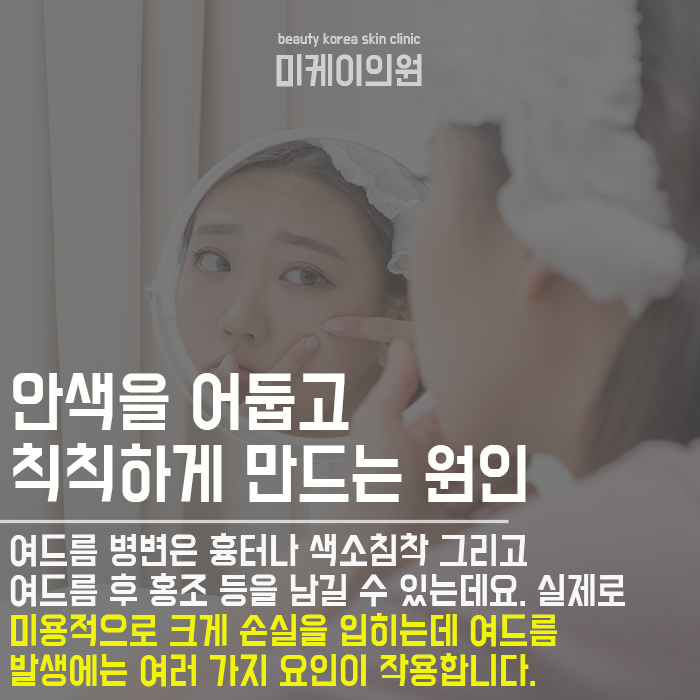 여드름검은색원인 개인에 따라 원인이 달라 관련 이미지 3