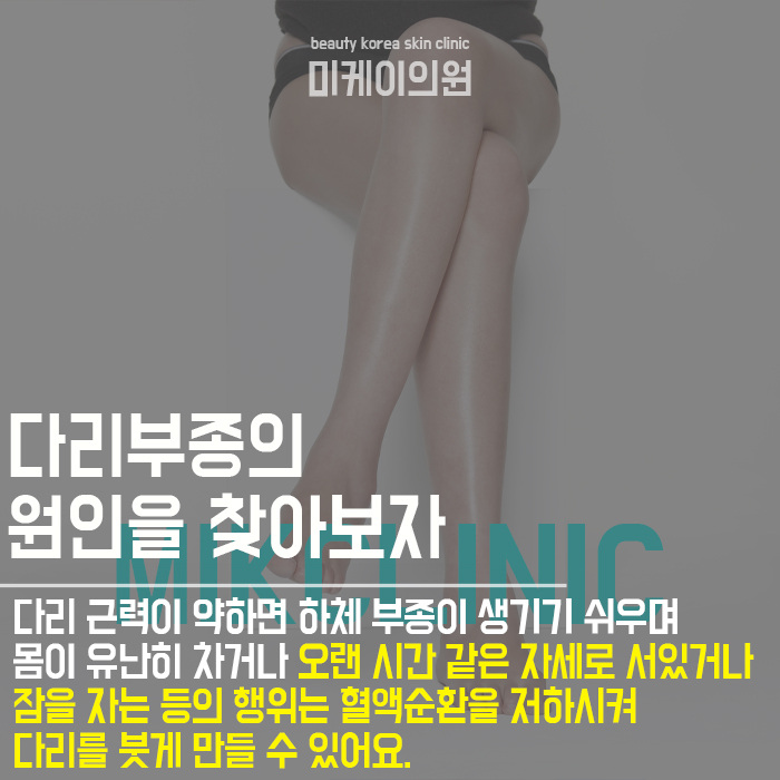 다리 붓기빼는 자세로 부종 정리할 수 있어요 관련 이미지 2