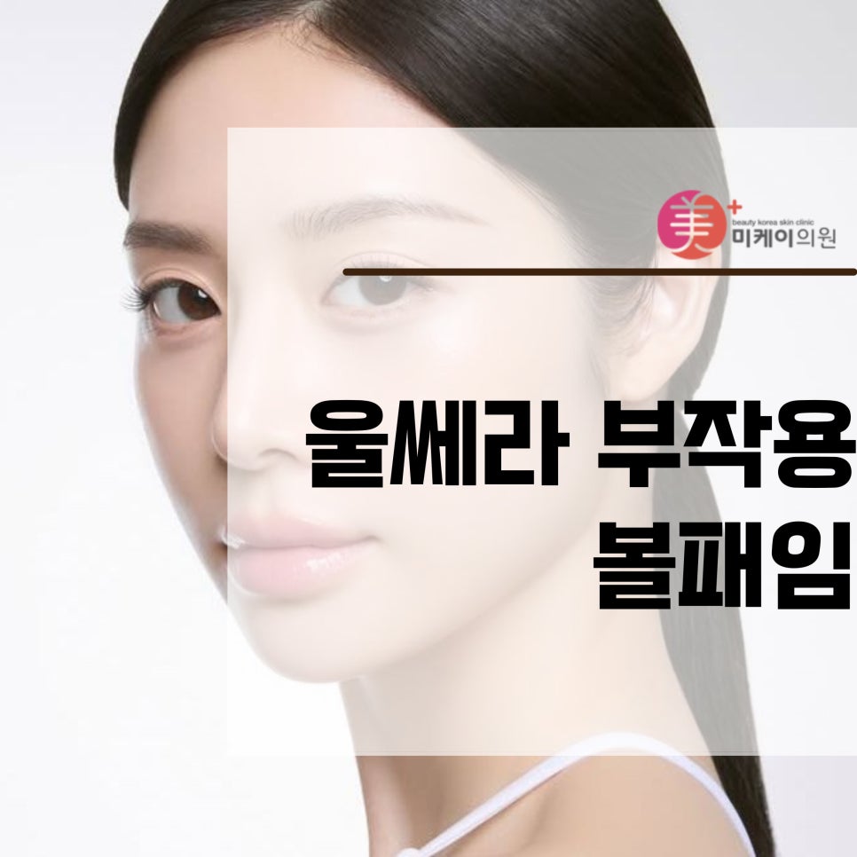 울쎄라 부작용 볼패임 미리 알아두기 관련 이미지 1