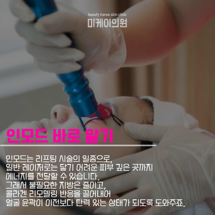 인모드리프팅가격 효율적으로 활용법은 관련 이미지 4