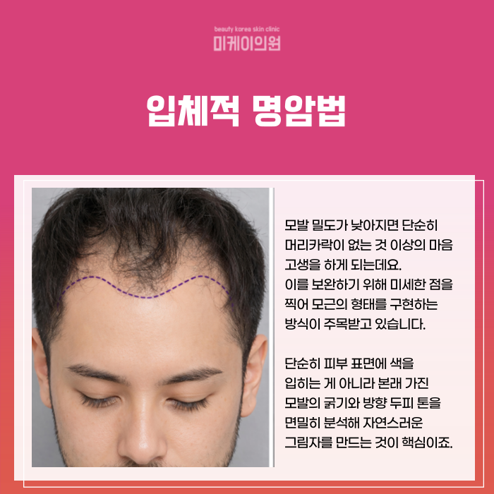 Gangnam Station, Seocho-gu SMP: Natural Hairline and Density image 2