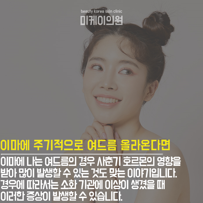 여드름유발원인 무엇 때문일까? 관련 이미지 2