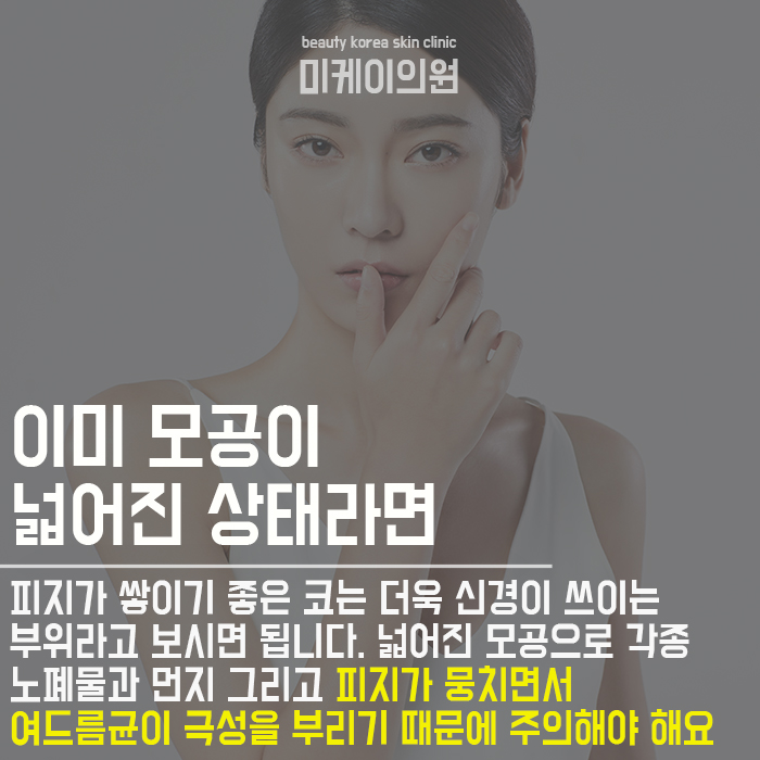 나비존관리 복잡하지 않아요 관련 이미지 2
