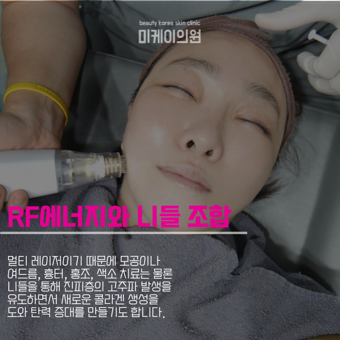 강남역 포텐자 연어주사 피부미인 되는 법 관련 이미지 2