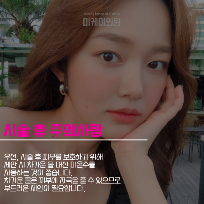 레이저리프팅종류 안티에이징 하는 방법 관련 이미지 5