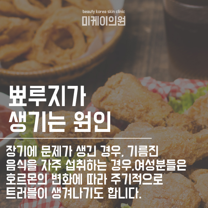얼굴 뾰루지 위치별 원인 및 없애는법 함께 확인해 보아요 관련 이미지 3