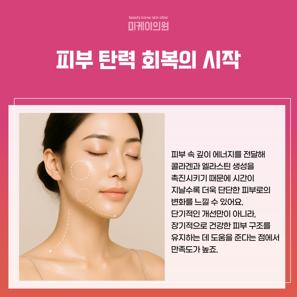 강남 이중턱 리프팅로 매끄러운 턱 라인 만들기 관련 이미지 2