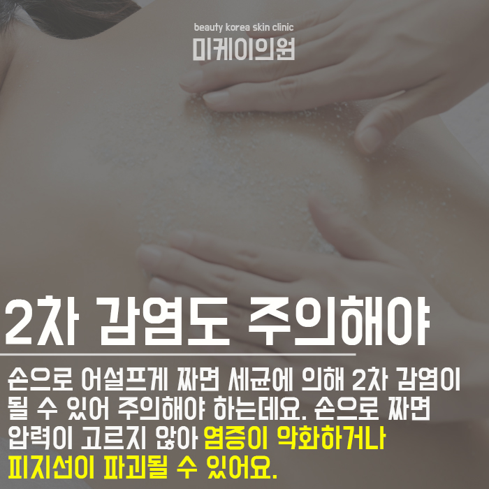 등드름자국제거방법 쉽고 간편하게 관련 이미지 3