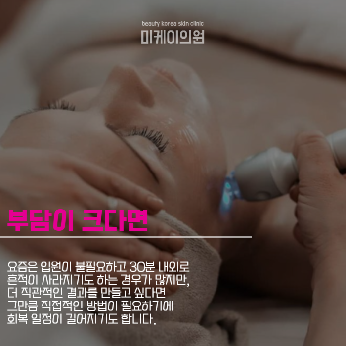 인모드 멍 기간 걱정으로 시작 못했다면 관련 이미지 2
