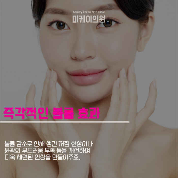 쥬베룩볼륨 원리 제대로 알고 시술받자 관련 이미지 4