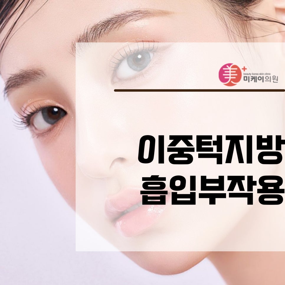 이중턱지방흡입부작용 피하려면 관련 이미지 1