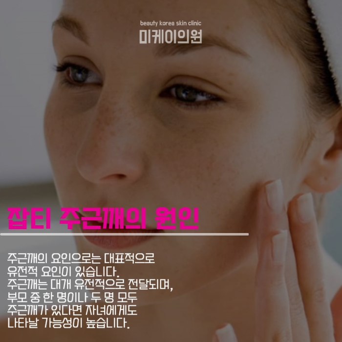 강남잡티주근깨레이저 정품으로 정량으로 관련 이미지 2