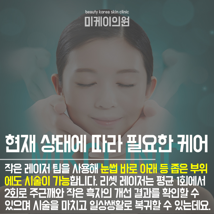 주근깨생기는원인 깔끔하게 개선하려면 관련 이미지 3