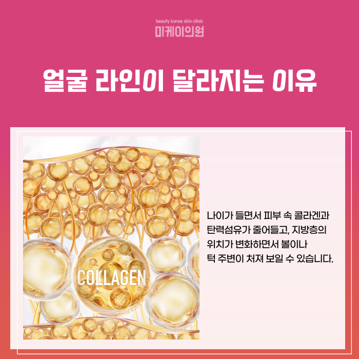 강남 인모드 이벤트 브이라인에 이만한거 없어요 관련 이미지 2