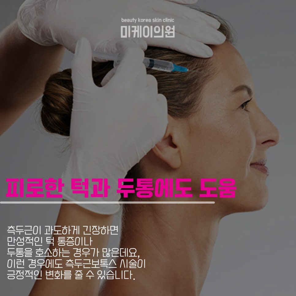 Temporal Muscle Botox Side Effects: Helpful to Know image 3