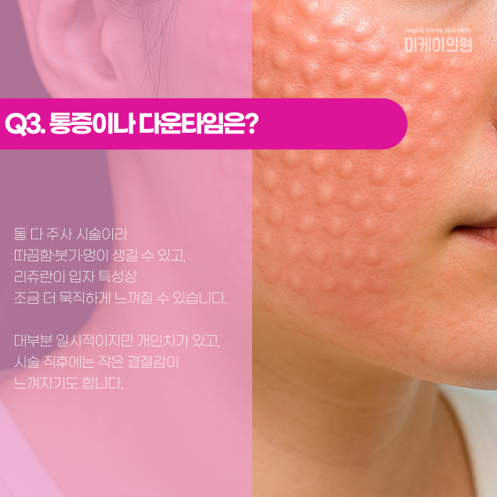 리쥬란 물광주사 차이, 헷갈린다면 한 번에 정리 관련 이미지 4