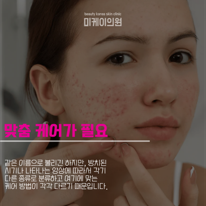 강남여드름피부과 마음의 짐을 덜려면 관련 이미지 3