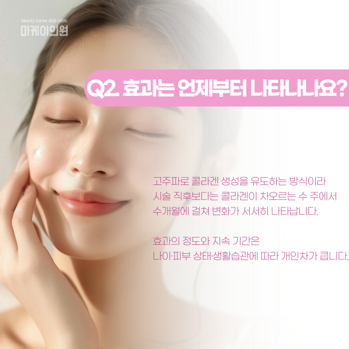 강남 덴서티, 고주파 리프팅 뭐가 다를까? 관련 이미지 3