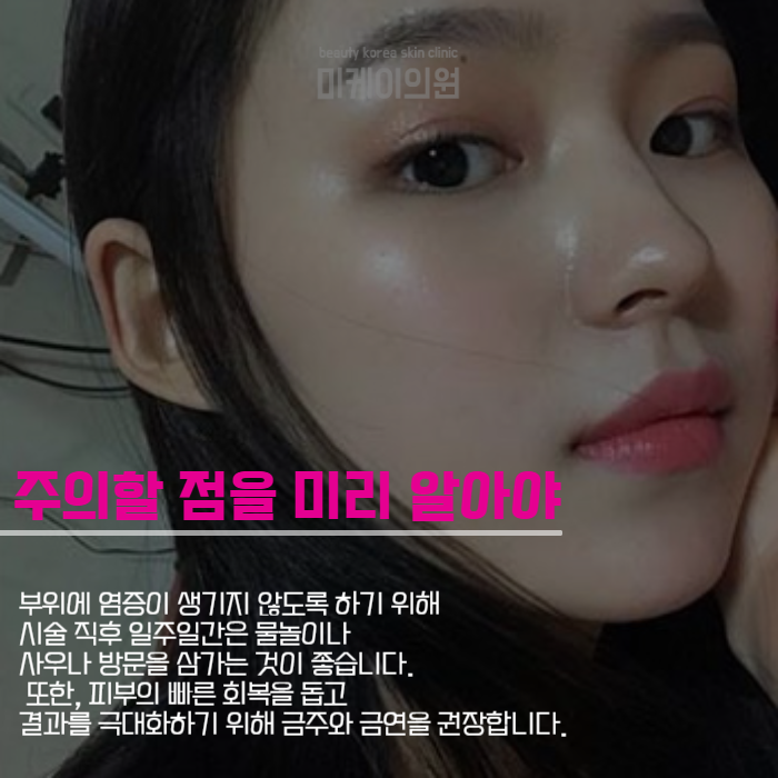 필러맞고주의사항 미리 확인하고 관리해보세요 관련 이미지 5