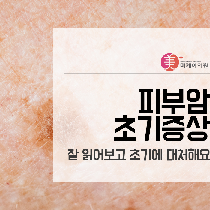 피부암초기증상 잘 읽어보고 초기에 대처해요 관련 이미지 1