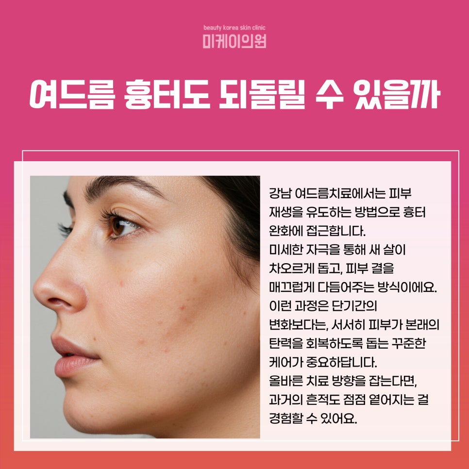 Start Gangnam Acne Treatment the Right Way image 4