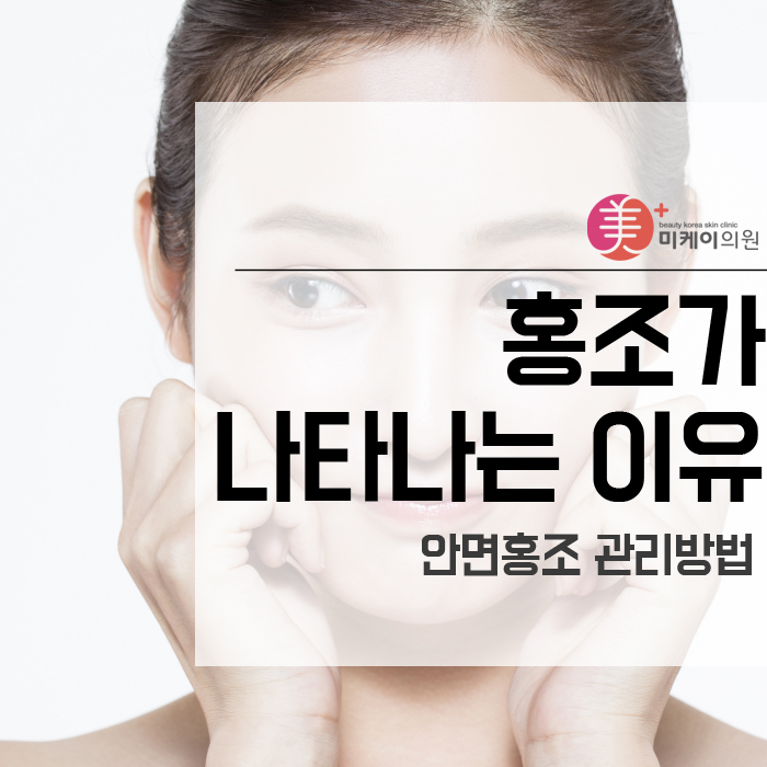 홍조가 나타나는 이유와 관리방법 관련 이미지 1