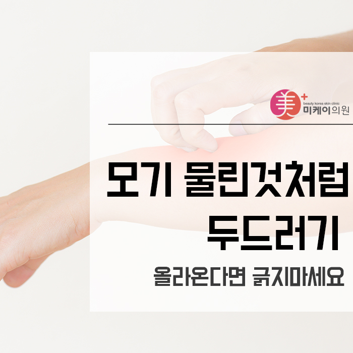 모기물린것처럼 두드러기 올라온다면 긁지마세요 관련 이미지 1