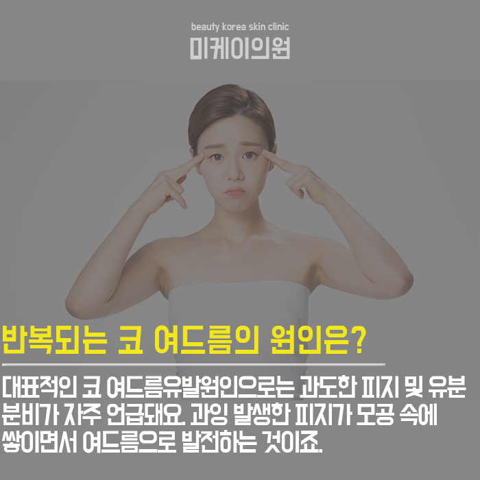 여드름유발원인 무엇 때문일까? 관련 이미지 3