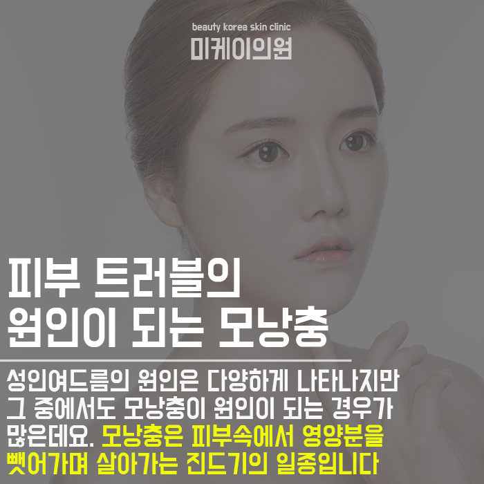 강남아쿠아필로모낭충제거 드라마틱한 결과 관련 이미지 2