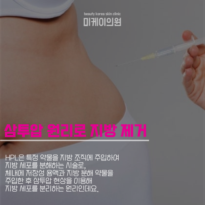 강남역 다이어트주사로 빠른 변화를 관련 이미지 4