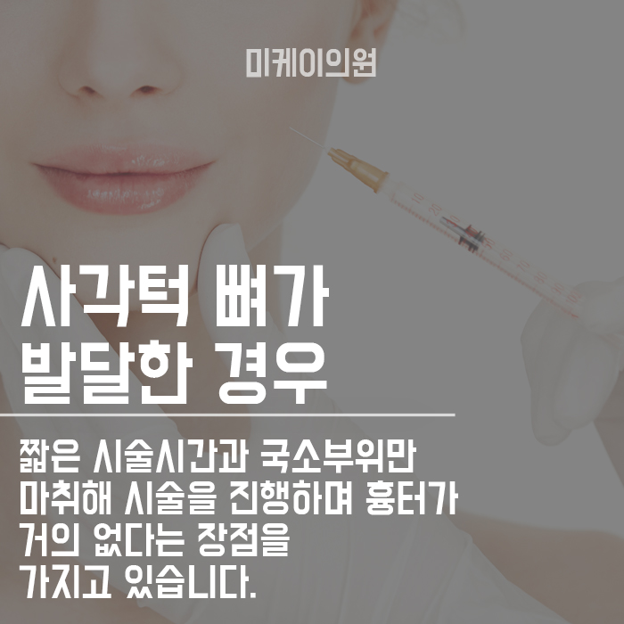 서초동사각턱보톡스 v라인 될 수 있어요 관련 이미지 2