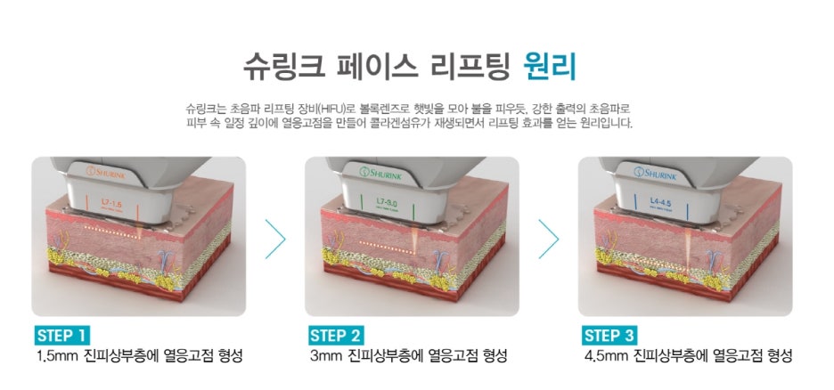 아이슈링크 눈가 탄력 개선할 수 있다 관련 이미지 2