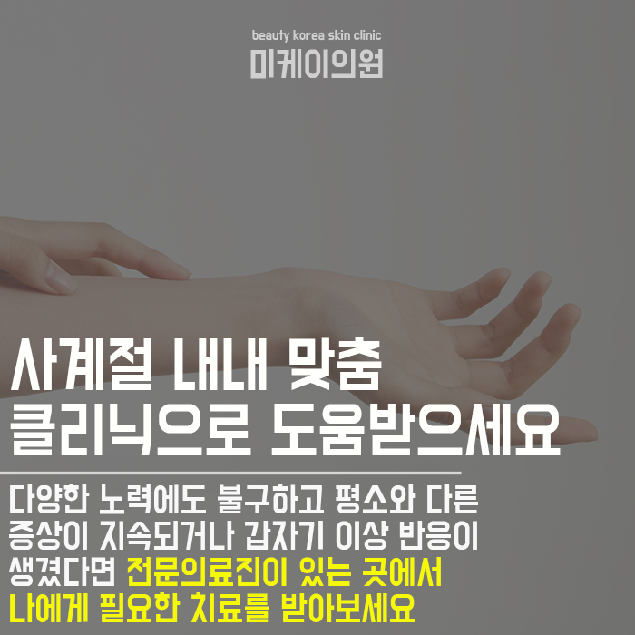 거칠어진손관리 쉽게관리해요 관련 이미지 6
