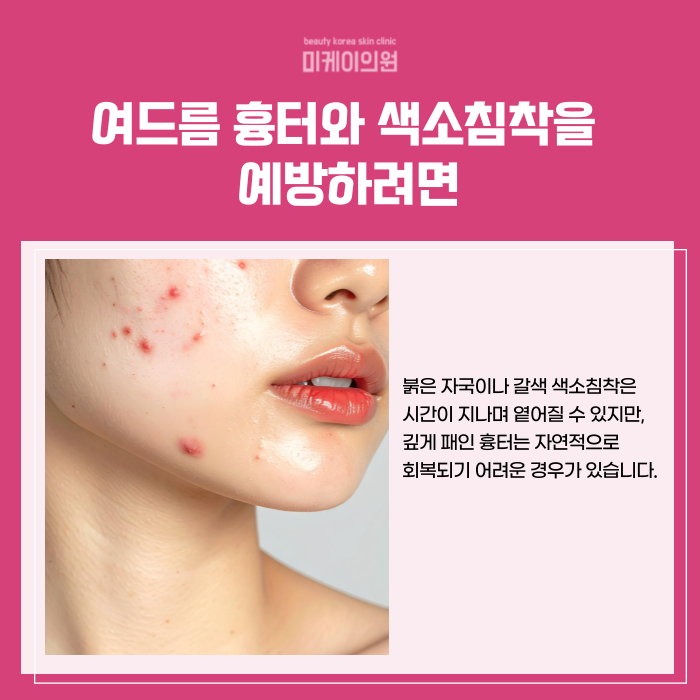 강남 여드름 피부과 잘하는곳 흉터 개선하고 싶다면 관련 이미지 4