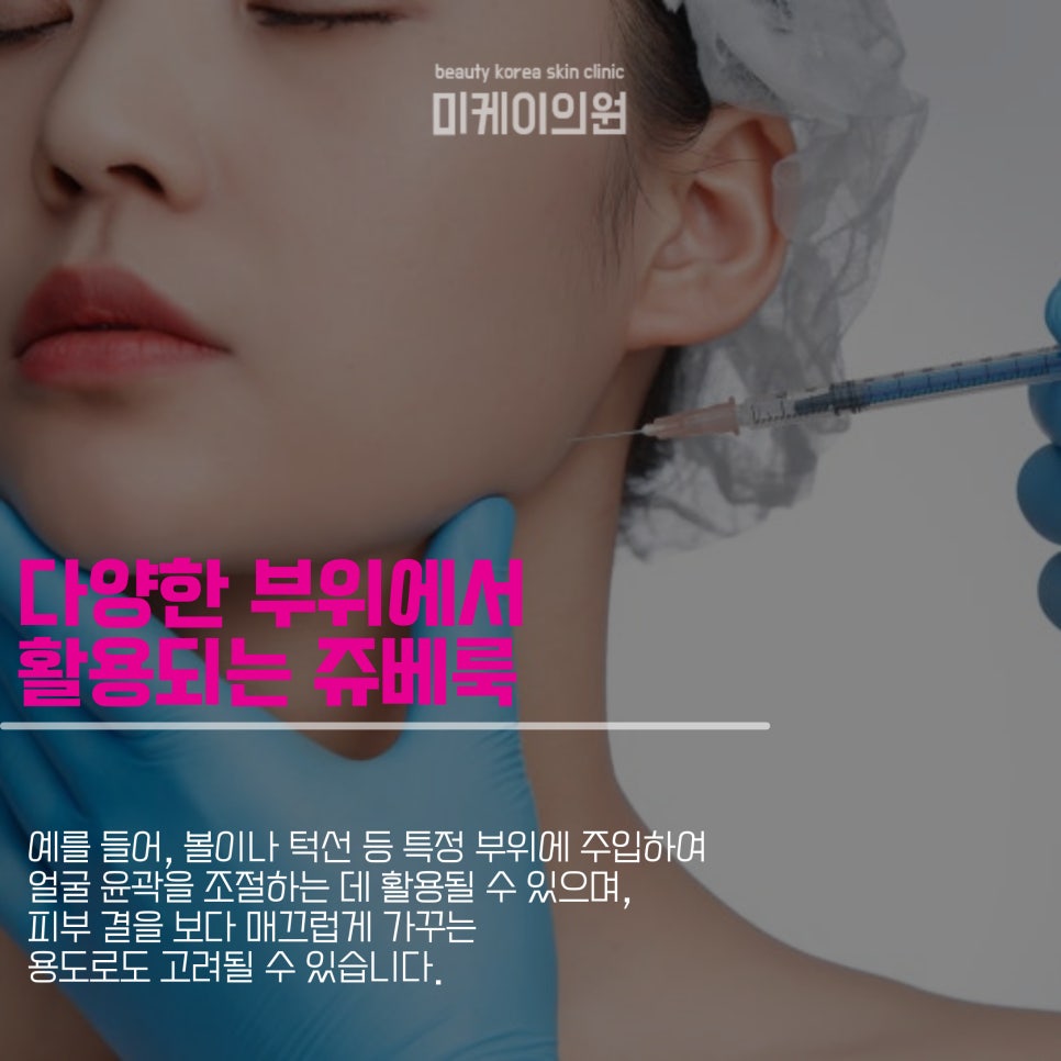 What Side Effects Can Juvellook Volume Have? image 4