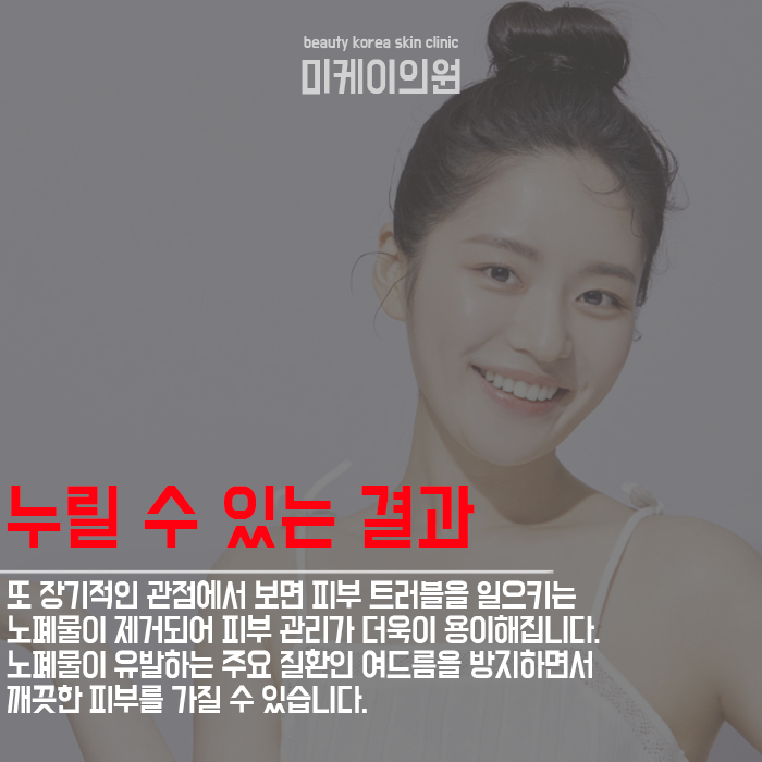 아쿠아필효과 통해서 케어하려면 관련 이미지 3