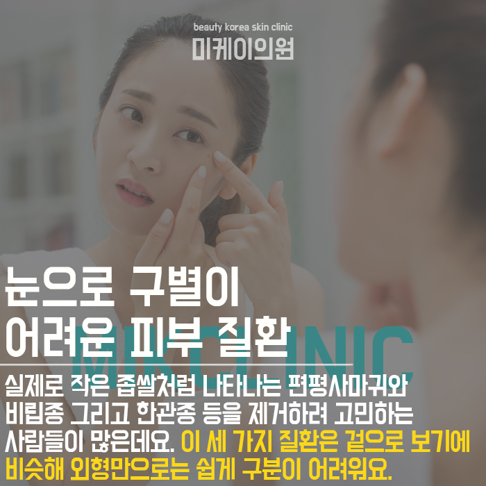 편평사마귀원인 개인에 따라 다를 수 있어 관련 이미지 2