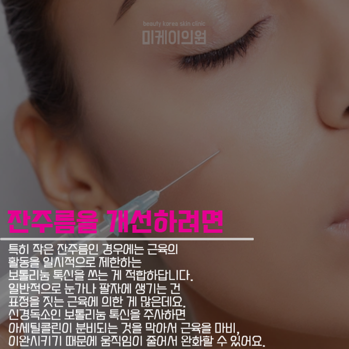 필러와보톡스차이 알아야 받을 수 있죠 관련 이미지 2