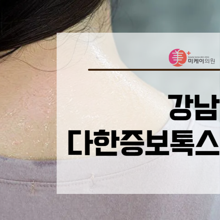 강남다한증보톡스 스트레스가 크다면 관련 이미지 1