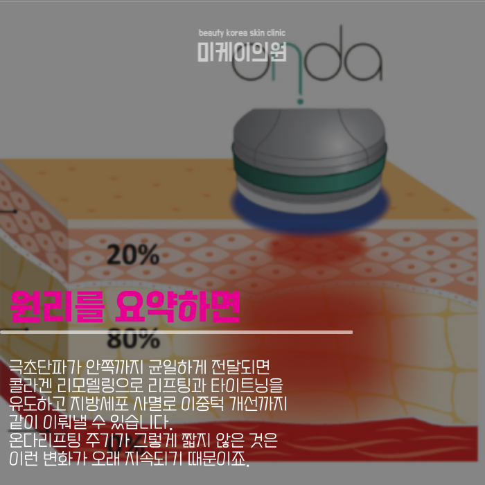 온다리프팅 주기 말고도 알아둘 것 관련 이미지 2