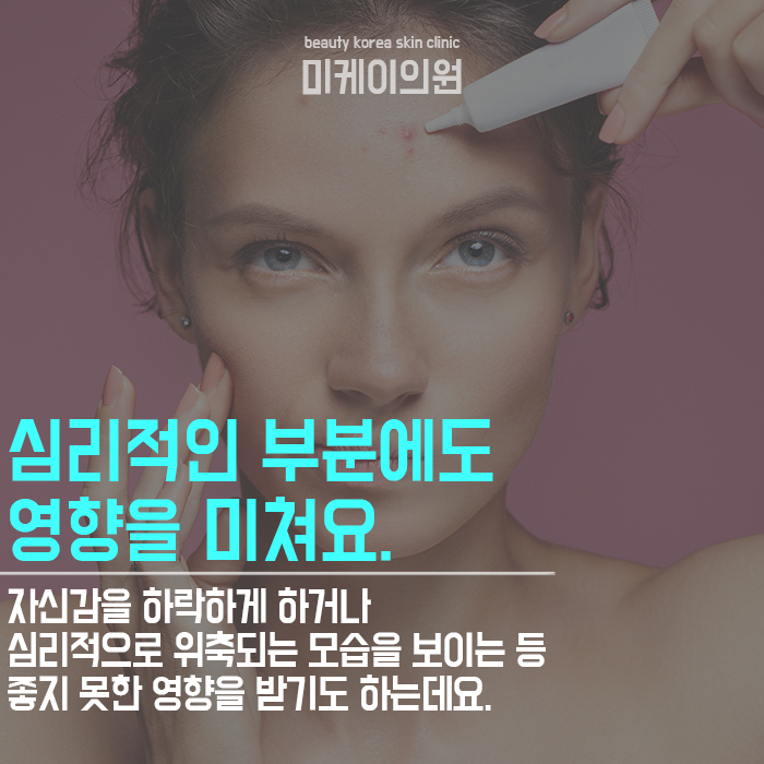 강남역여드름의원 개인별 피부타입에 맞는 관리를 해요 관련 이미지 5