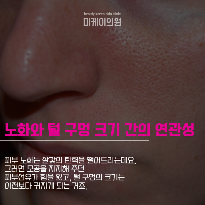 얼굴모공줄이는방법 클렌징부터 아쿠아필까지 관련 이미지 3