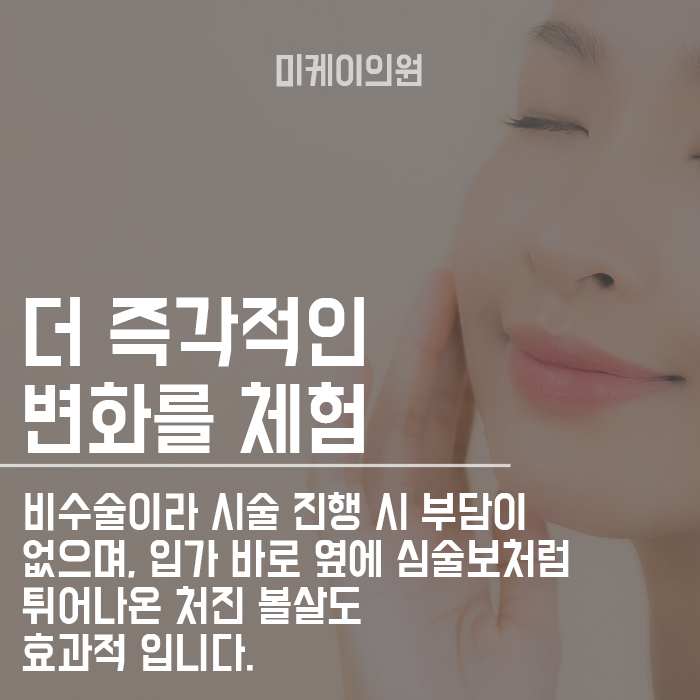 캐번실리프팅 팔자주름 당기고 채우자 관련 이미지 4