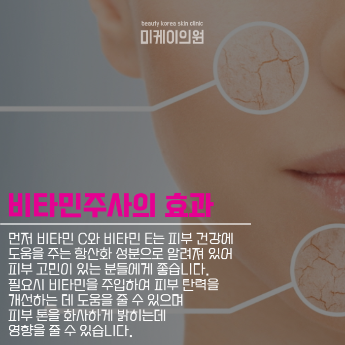 비타민주사효과 및 주의사항 알아보기 관련 이미지 3