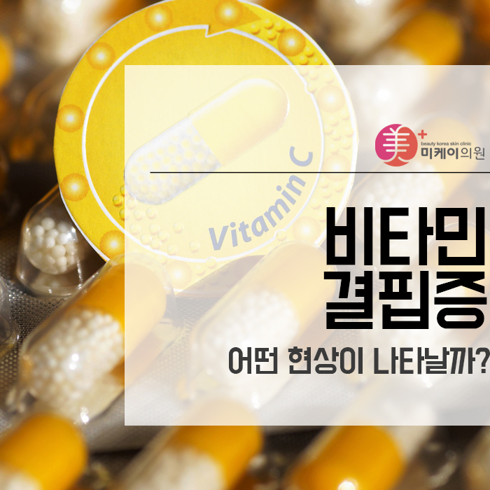 비타민 결핍증 어떤 현상이 나타날까? 관련 이미지 1