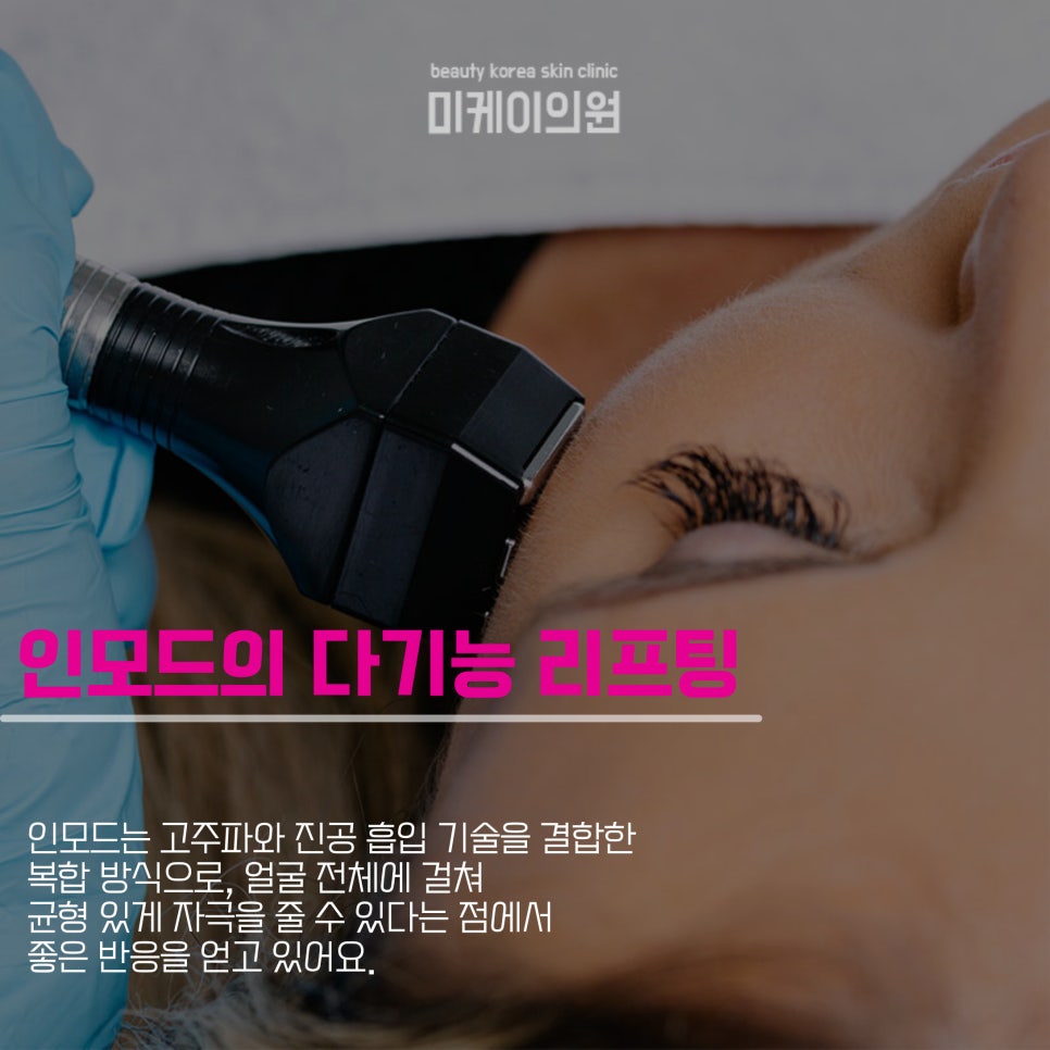 If You're Worried About Thermage Side Effects and Hollow Cheeks image 4