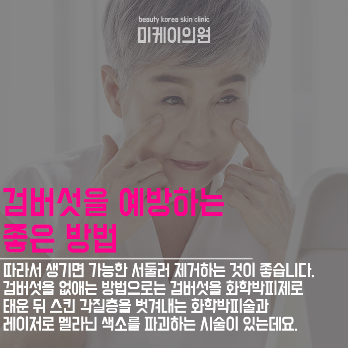 검버섯에좋은음식 셀프관리로 변화가 없다면 상담부터 관련 이미지 2