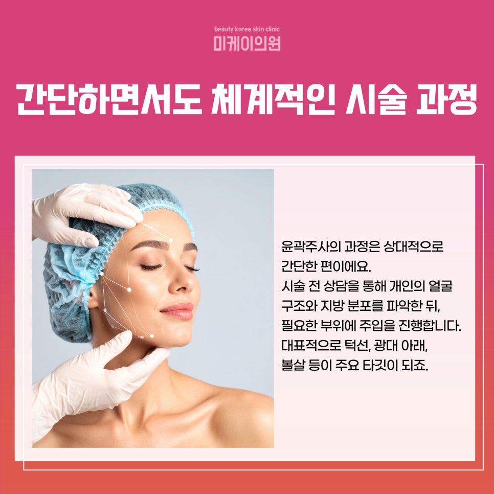 서초동 윤곽주사 얼굴 라인을 살려줘 관련 이미지 3