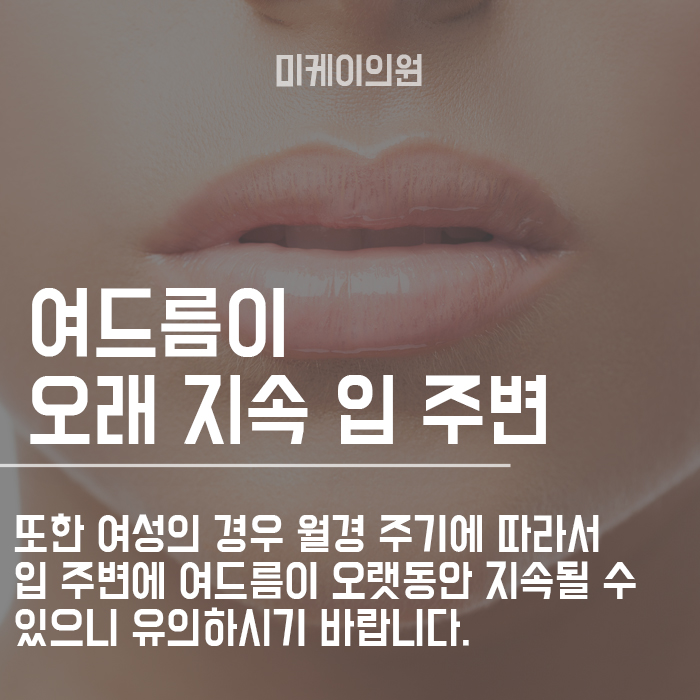 얼굴 부위별 여드름 원인 알고 관리해봐요 관련 이미지 3