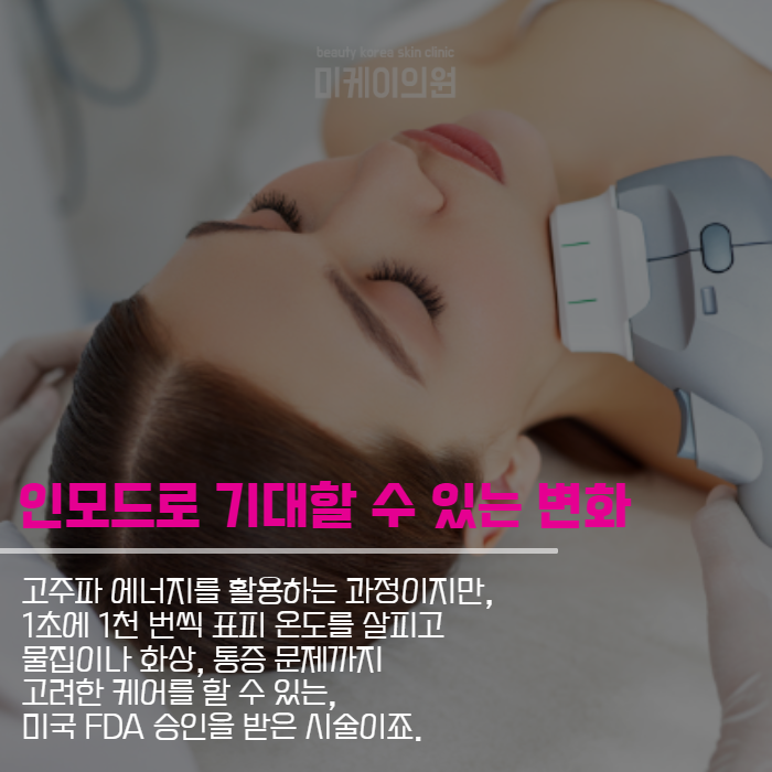 처진살리프팅 여러 가지 방식에 대해 관련 이미지 5